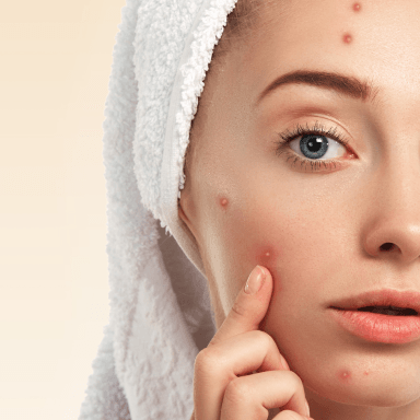 Do acne patches work? How to use acne patches? What are the types of acne patches? How to manufacture acne patches to sell?