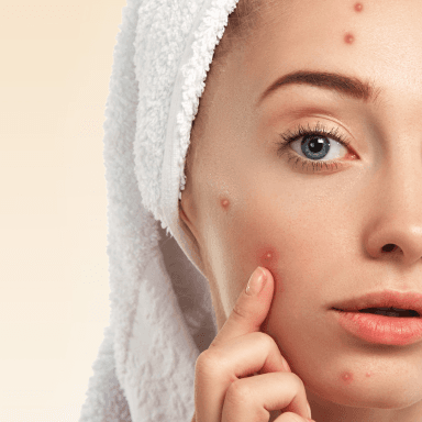 Do acne patches work? How to use acne patches? What are the types of acne patches? How to manufacture acne patches to sell?